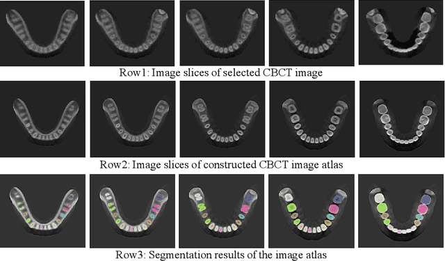 Figure 4 for Construction of unbiased dental template and parametric dental model for precision digital dentistry