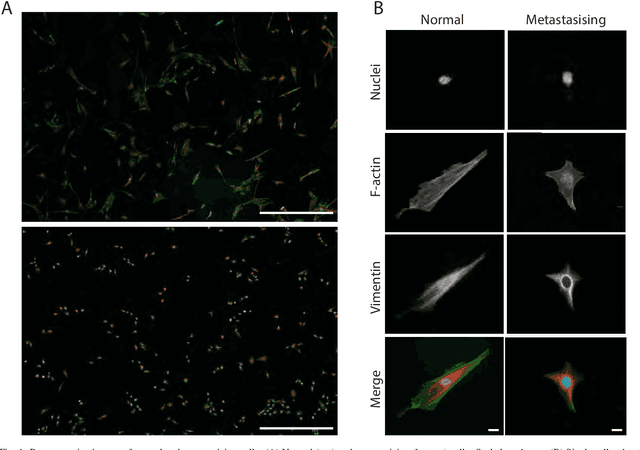 Figure 1 for A novel framework employing deep multi-attention channels network for the autonomous detection of metastasizing cells through fluorescence microscopy
