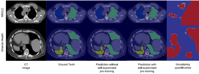 Figure 2 for Self-Supervised Learning for Organs At Risk and Tumor Segmentation with Uncertainty Quantification