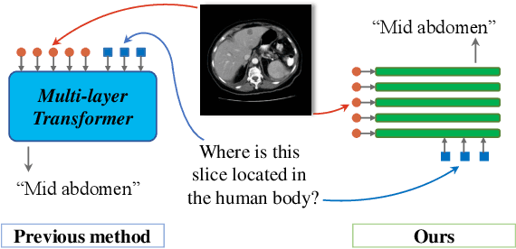 Figure 1 for MF2-MVQA: A Multi-stage Feature Fusion method for Medical Visual Question Answering