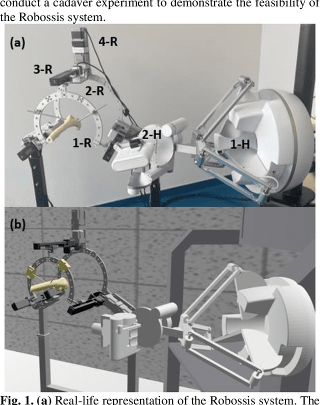 Figure 1 for Design and Experimental Evaluation of a Haptic Robot-Assisted System for Femur Fracture Surgery