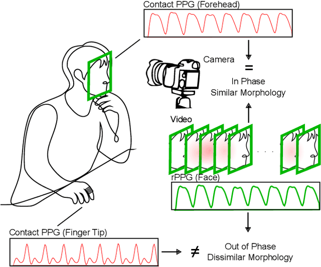 Figure 1 for How Suboptimal is Training rPPG Models with Videos and Targets from Different Body Sites?