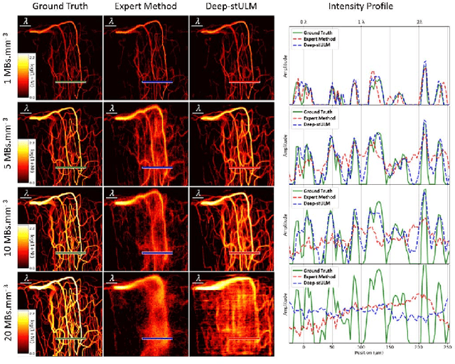 Figure 4 for A Deep Learning Framework for Spatiotemporal Ultrasound Localization Microscopy