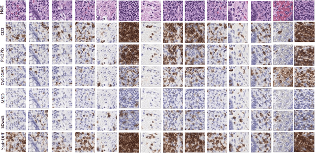 Figure 3 for StainDiffuser: MultiTask Dual Diffusion Model for Virtual Staining