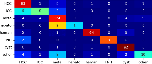 Figure 4 for Liver Tumor Screening and Diagnosis in CT with Pixel-Lesion-Patient Network