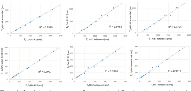 Figure 2 for Time-efficient, High Resolution 3T Whole Brain Quantitative Relaxometry using 3D-QALAS with Wave-CAIPI Readouts