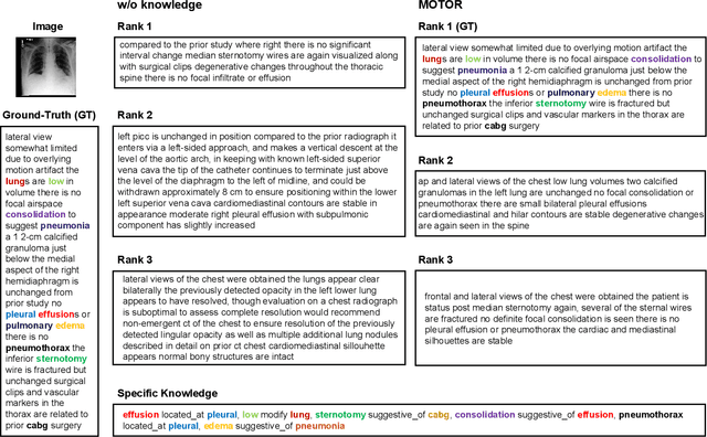 Figure 3 for Towards Medical Artificial General Intelligence via Knowledge-Enhanced Multimodal Pretraining