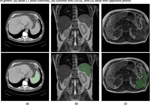 Figure 1 for Duke Spleen Data Set: A Publicly Available Spleen MRI and CT dataset for Training Segmentation