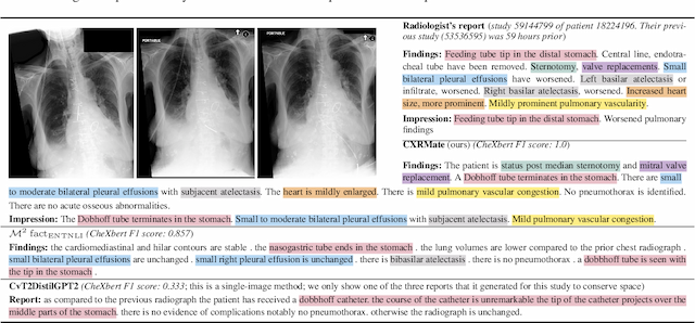 Figure 4 for Longitudinal Data and a Semantic Similarity Reward for Chest X-Ray Report Generation