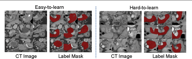 Figure 4 for Data-Centric Diet: Effective Multi-center Dataset Pruning for Medical Image Segmentation