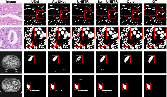 Figure 3 for Rethinking Boundary Detection in Deep Learning Models for Medical Image Segmentation
