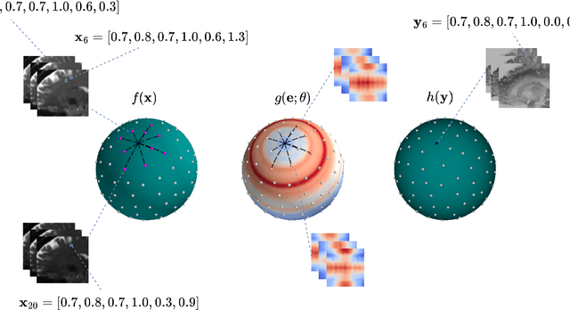 Figure 1 for Spatio-Angular Convolutions for Super-resolution in Diffusion MRI