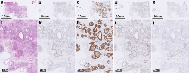 Figure 1 for The ACROBAT 2022 Challenge: Automatic Registration Of Breast Cancer Tissue