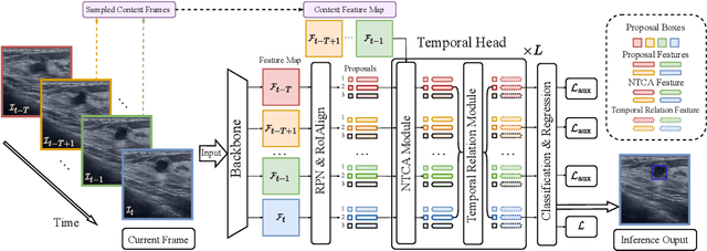 Figure 4 for Mining Negative Temporal Contexts For False Positive Suppression In Real-Time Ultrasound Lesion Detection
