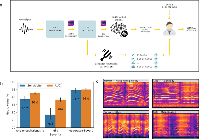 Figure 1 for A cry for help: Early detection of brain injury in newborns
