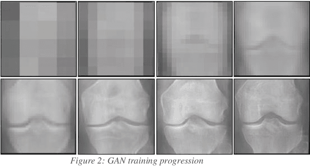 Figure 3 for Synthetic Medical Imaging Generation with Generative Adversarial Networks For Plain Radiographs