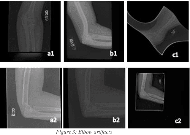 Figure 4 for Synthetic Medical Imaging Generation with Generative Adversarial Networks For Plain Radiographs