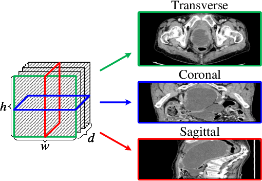 Figure 1 for Multi-View Attention Learning for Residual Disease Prediction of Ovarian Cancer