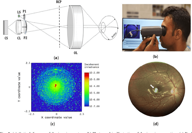 Figure 2 for A portable widefield fundus camera with high dynamic range imaging capability