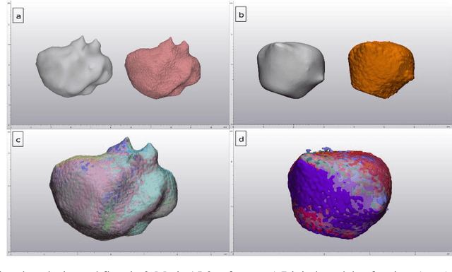 Figure 3 for Realistic 3D printed imaging tumor phantoms for validation of image processing algorithms