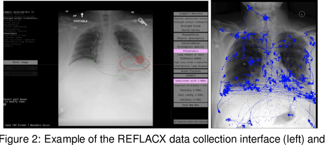Figure 3 for Integrating Eye-Gaze Data into CXR DL Approaches: A Preliminary study