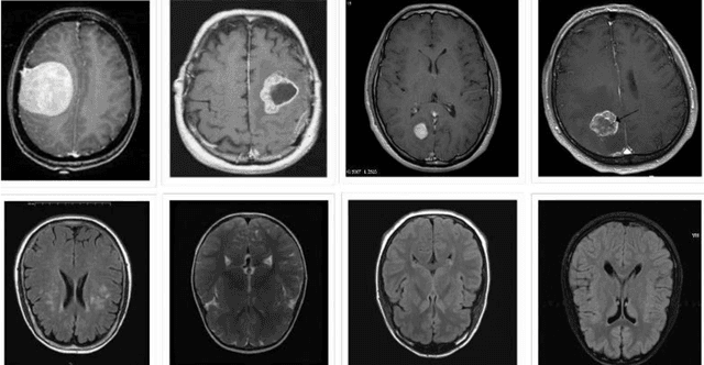 Figure 1 for A deep learning approach for brain tumor detection using magnetic resonance imaging