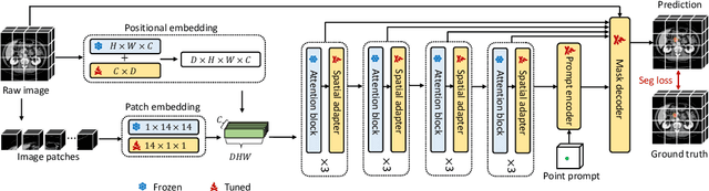 Figure 1 for 3DSAM-adapter: Holistic Adaptation of SAM from 2D to 3D for Promptable Medical Image Segmentation