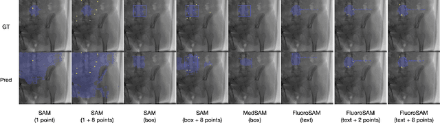 Figure 4 for FluoroSAM: A Language-aligned Foundation Model for X-ray Image Segmentation