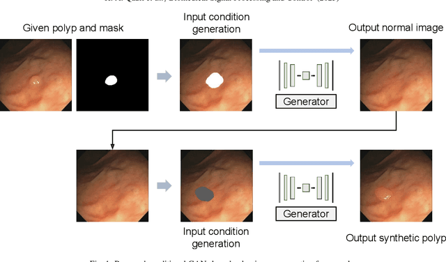 Figure 1 for Simple U-net Based Synthetic Polyp Image Generation: Polyp to Negative and Negative to Polyp