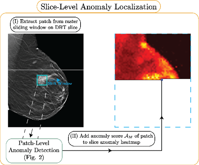 Figure 1 for Unsupervised anomaly localization in high-resolution breast scans using deep pluralistic image completion
