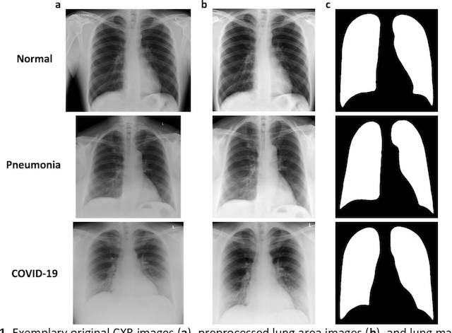 Figure 2 for POLCOVID: a multicenter multiclass chest X-ray database (Poland, 2020-2021)