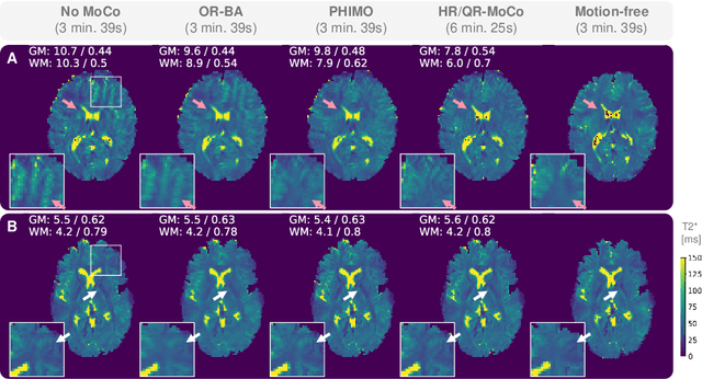 Figure 3 for Physics-Informed Deep Learning for Motion-Corrected Reconstruction of Quantitative Brain MRI