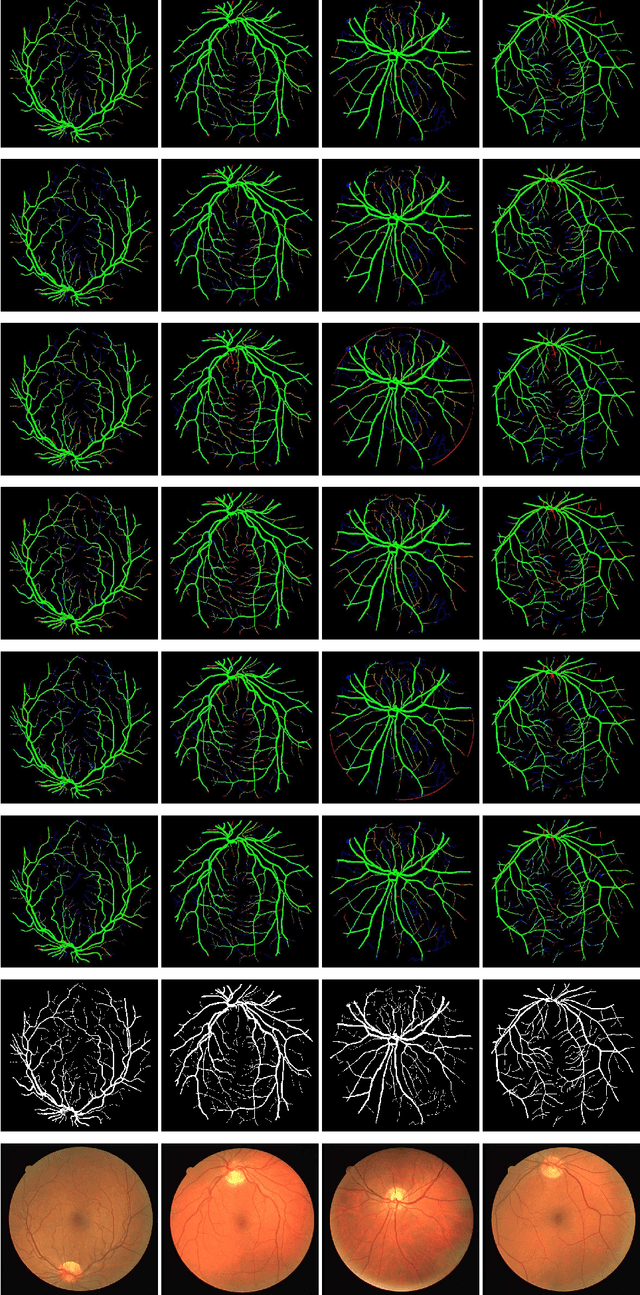 Figure 1 for LDMRes-Net: Enabling Real-Time Disease Monitoring through Efficient Image Segmentation