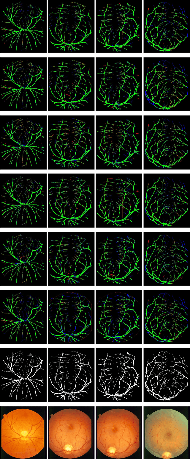 Figure 2 for LDMRes-Net: Enabling Real-Time Disease Monitoring through Efficient Image Segmentation