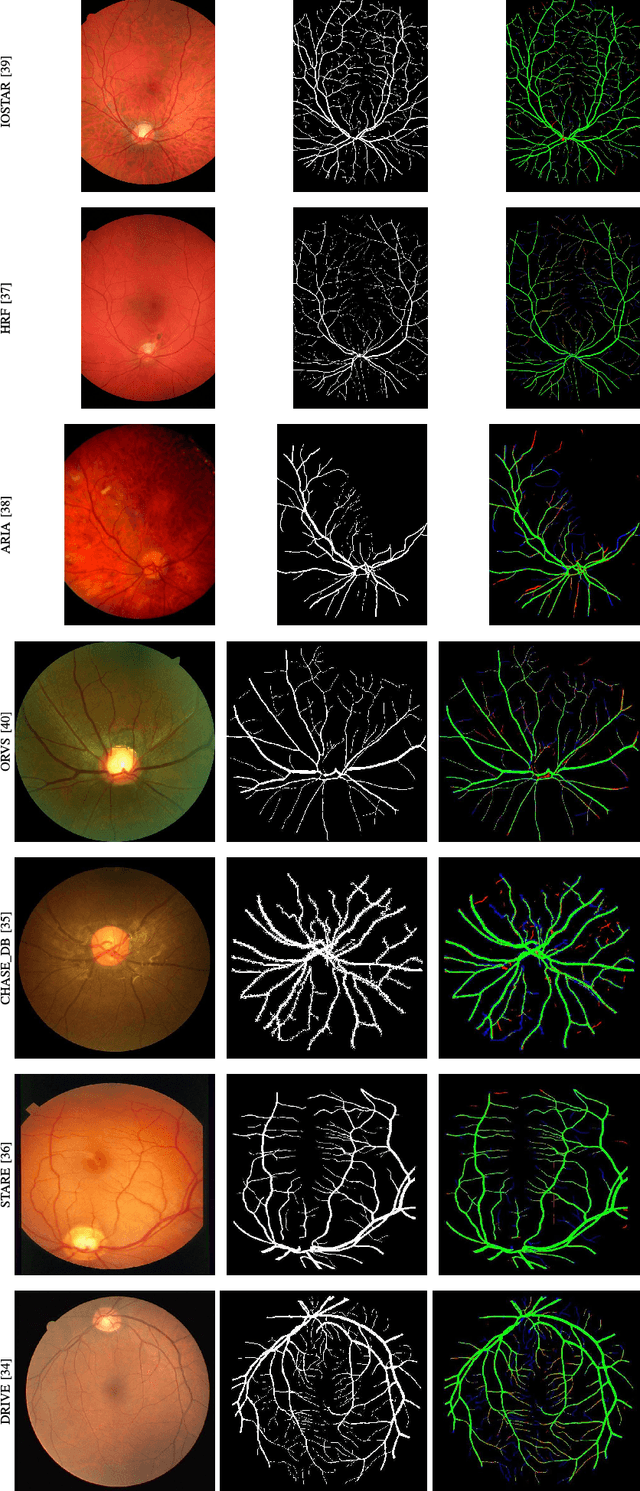 Figure 3 for LDMRes-Net: Enabling Real-Time Disease Monitoring through Efficient Image Segmentation