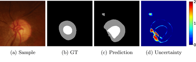 Figure 1 for Towards Generalizable Medical Image Segmentation with Pixel-wise Uncertainty Estimation