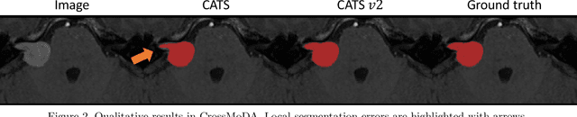 Figure 3 for CATS v2: Hybrid encoders for robust medical segmentation