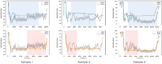 Figure 1 for A Transformer-based Prediction Method for Depth of Anesthesia During Target-controlled Infusion of Propofol and Remifentanil