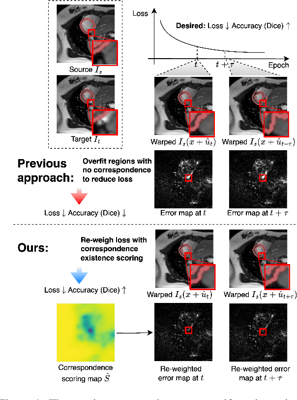 Figure 1 for An Adaptive Correspondence Scoring Framework for Unsupervised Image Registration of Medical Images