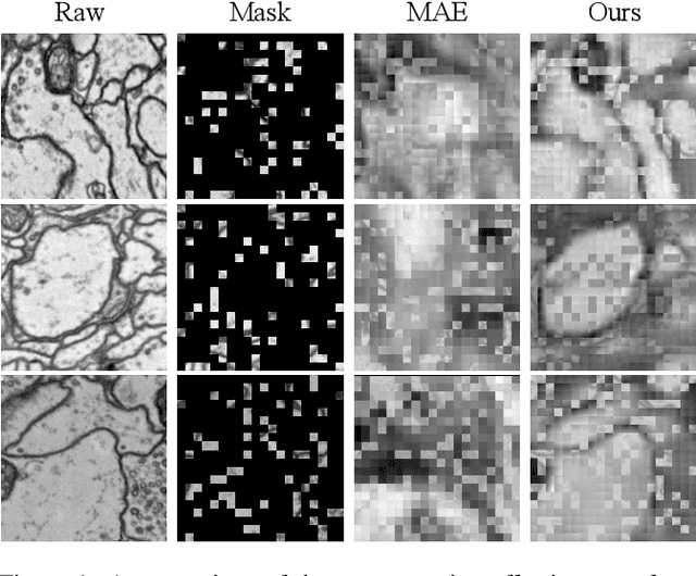 Figure 1 for Self-Supervised Neuron Segmentation with Multi-Agent Reinforcement Learning