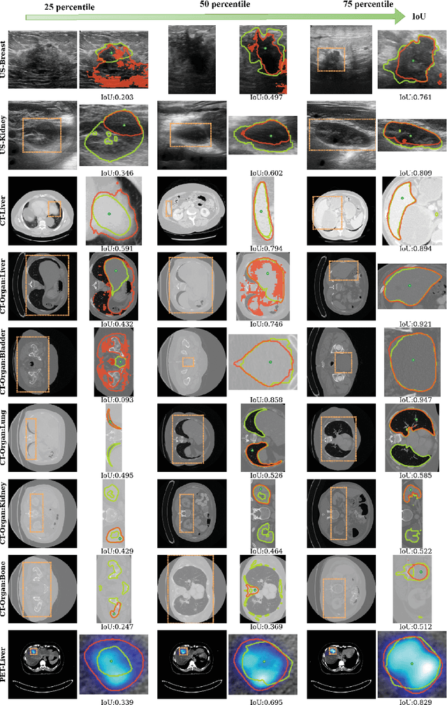 Figure 4 for Segment Anything Model for Medical Image Analysis: an Experimental Study