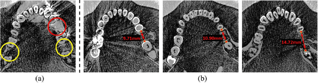 Figure 1 for Two-Stream Regression Network for Dental Implant Position Prediction