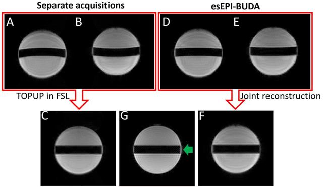 Figure 3 for Three-dimensional echo-shifted EPI with simultaneous blip-up and blip-down acquisitions for correcting geometric distortion