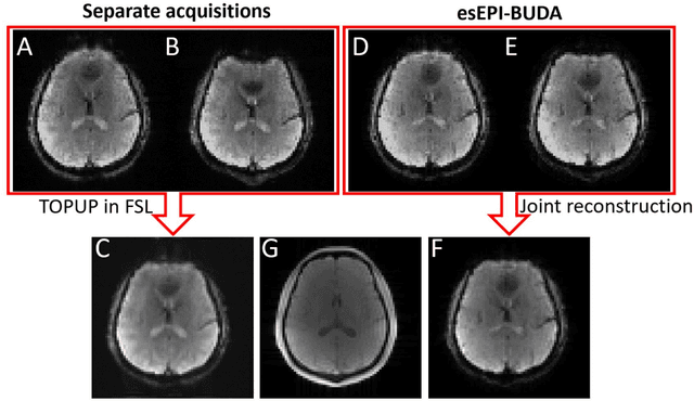 Figure 4 for Three-dimensional echo-shifted EPI with simultaneous blip-up and blip-down acquisitions for correcting geometric distortion