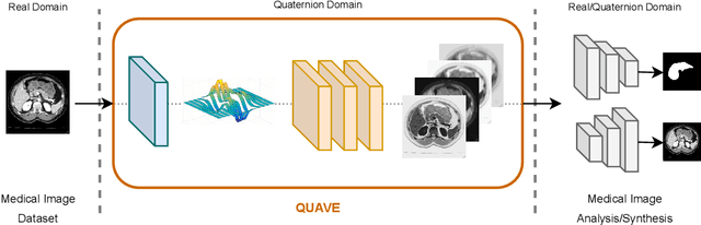 Figure 1 for Generalizing Medical Image Representations via Quaternion Wavelet Networks