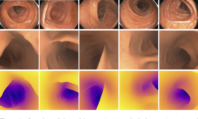 Figure 1 for SimCol3D -- 3D Reconstruction during Colonoscopy Challenge
