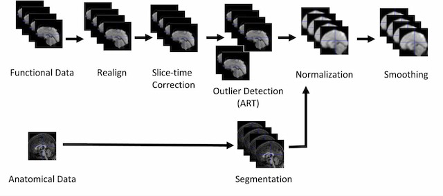 Figure 2 for A Network Theory Investigation into the Altered Resting State Functional Connectivity in Attention-Deficit Hyperactivity Disorder