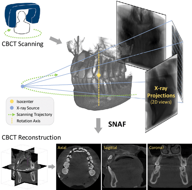 Figure 1 for SNAF: Sparse-view CBCT Reconstruction with Neural Attenuation Fields