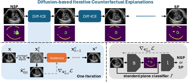 Figure 3 for Diffusion-based Iterative Counterfactual Explanations for Fetal Ultrasound Image Quality Assessment