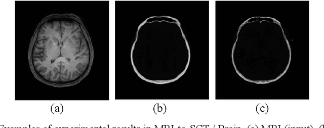 Figure 4 for Synthesizing 3D computed tomography from MRI or CBCT using 2.5D deep neural networks